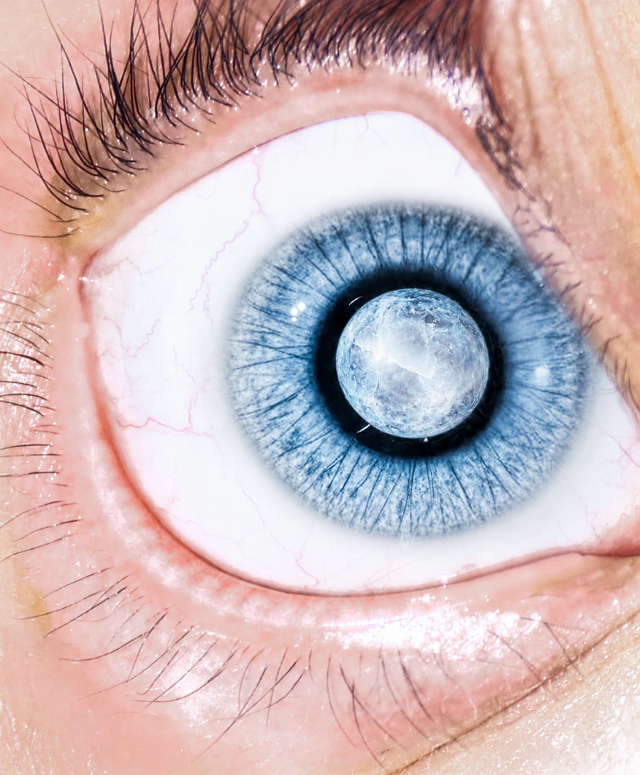 Close-up of an eye with an ice sphere reflected in the pupil